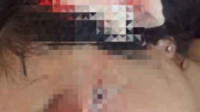 Ibu Rumah Tangga di Tanggamus Disayat Pisau Suami Siri, Luka Parah di Kepala dan Bahu